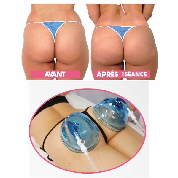 Franchise Relooking Beauté Minceur : nouveau soin qui arrive avec le lifting colombien